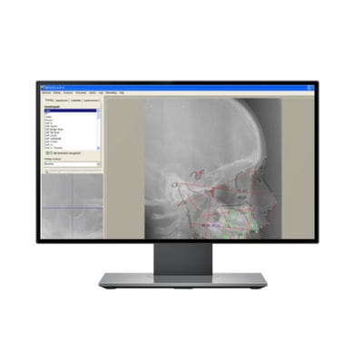 Software para imagiologia dentária - DFO - IMAGELEVEL - de imagiologia ortopédica / de análise cefalométrica / para tablet