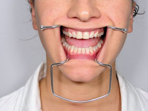 Afastador de bochecha - CRO2 - Jakobi Dental GmbH - odontológico / para adulto / em aço inoxidável