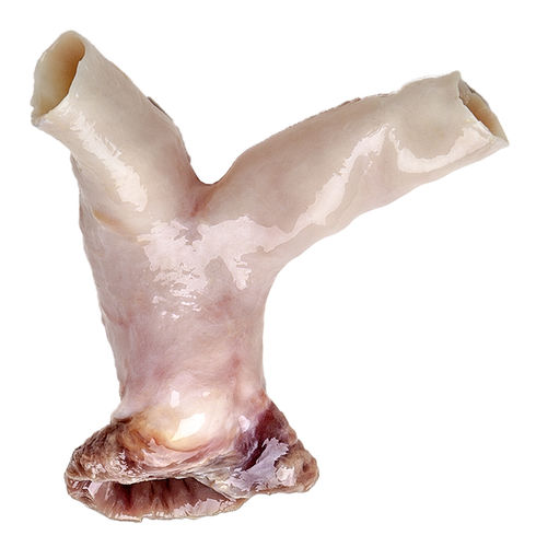 Bioprótese valvar pulmonar - CardioGraft® - Lifenet Health  