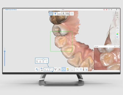 Software de captura - Medit   - clínico / odontológico / mandibular