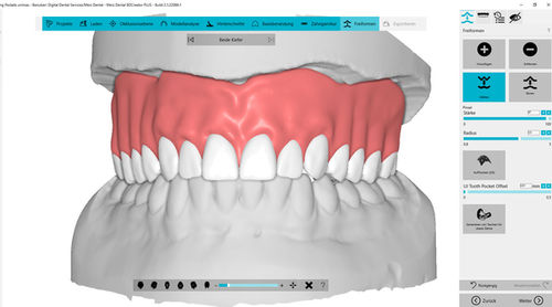 Software de análise - BDCreator® PLUS - Merz Dental GmbH   - de design / de importação / de impressão