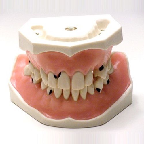Modelo anatômico de dentição - SP005 - Navadha Enterprises   - de periodontia / para ensino