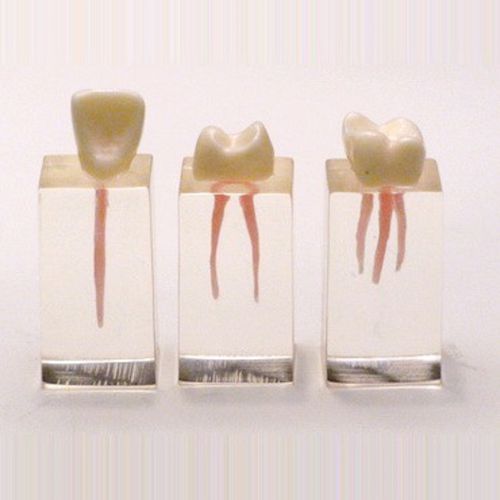 Modelo de dente - SP010 - Navadha Enterprises   - de endodontia / para ensino