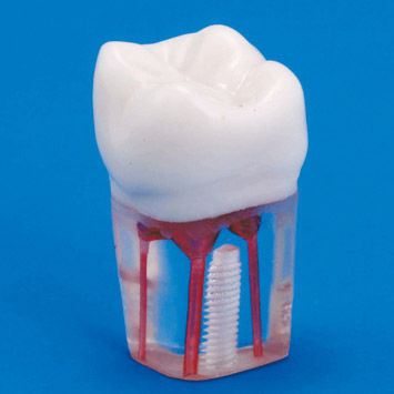 Modelo de dente - S12A-200 - Nissin Dental Products Inc.   - de canal radicular / para treinamento / transparente