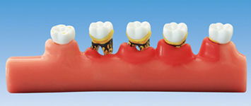 Modelo anatômico odontológico - PE-PER010 - Nissin Dental Products Inc.   - de costelas / de periodontia / para ensino