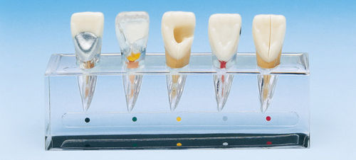 Modelo anatômico odontológico - PE-END001 - Nissin Dental Products Inc.   - de canal radicular / de endodontia / para ensino