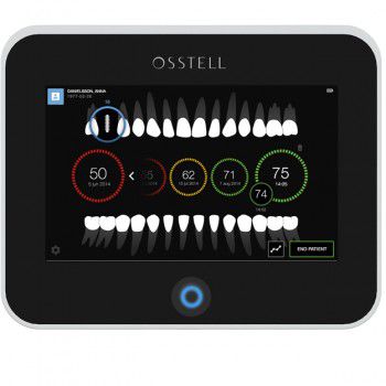 Monitor de estabilidade de implantes com touch screen - Osstell IDx - OSSTELL AB  