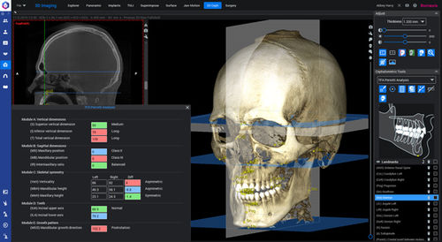 Software de análise cefalométrica - Romexis®  - Planmeca - de visualização 3D / de medição / de simulação 3D