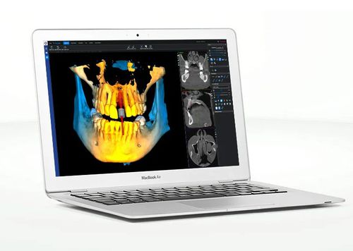 Aplicativo Web visualizador - Romexis®  - Planmeca - médico-hospitalar / odontológico / odontológico