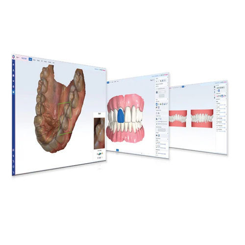 Software de planejamento - Romexis®  - Planmeca - de tratamento / CAD / de concepção de prótese dentária