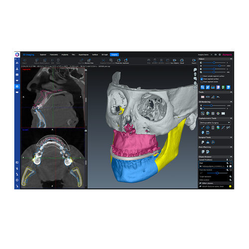 Software de análise cefalométrica - Romexis® - Planmeca - de planejamento de tratamento / médico-hospitalar / para cirurgia maxilofacial