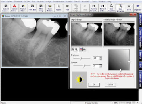 Software de captura de imagens - Prof. Suni - Suni Medical Imaging - de gestão de dados / de diagnóstico / para imagiologia dentária