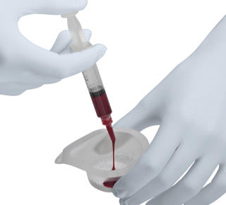 Substituto ósseo sintético - Ceros® TCP  - Thommen Medical AG   - para cirurgia ortopédica / em pasta
