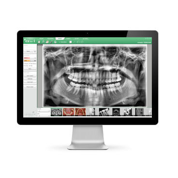 Software de criação de laudos - EzDent-i™ - VATECH Networks - de simulação / de análise de imagens / de análise de dados