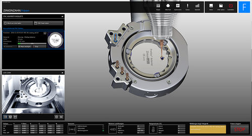 Software de visualização 3D - Fräsen  - Zirkonzahn - de simulação / para laboratório de prótese dentária