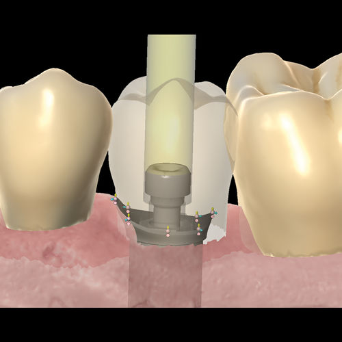 Módulo de software de concepção de prótese dentária - Reality Mode - Zirkonzahn - de visualização 3D / CAM / CAD