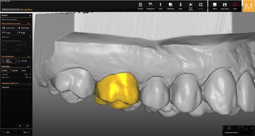 Módulo de software de maquetagem - Modellier - Zirkonzahn - de modelagem / para laboratório de prótese dentária