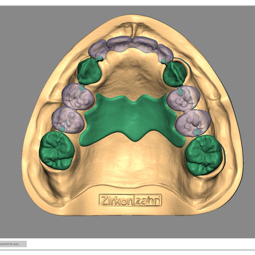 Software de importação - Partial-Planner - Zirkonzahn - de simulação 3D / de concepção de prótese dentária / para restauração dentária