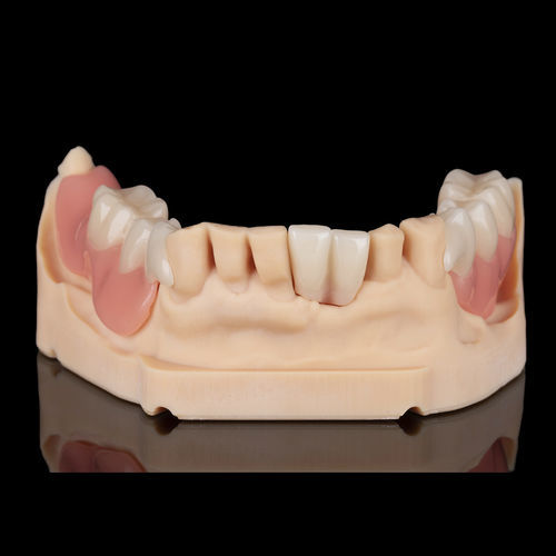 Prótese dentária de resina - Flexmon Partials - Zirkonzahn - sob medida / removível
