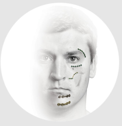 Placa de compressão óssea para mandíbula - TraumaOne™ - Zimmer Biomet - para esqueleto facial / bloqueada / metálica