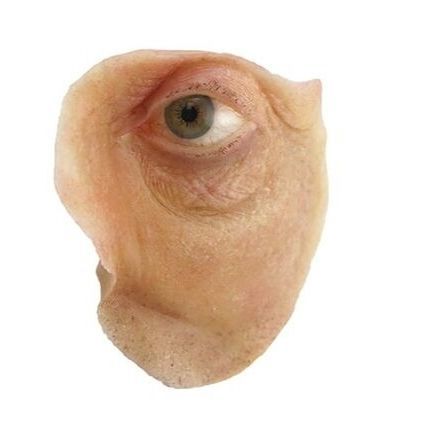 Prótese estética orbital - The Anaplastology Clinic - para adulto