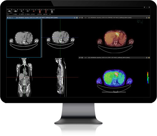 PACS para exames de imagem - INFINITT PACS - Infinitt Healthcare - baseado em tecnologia Web