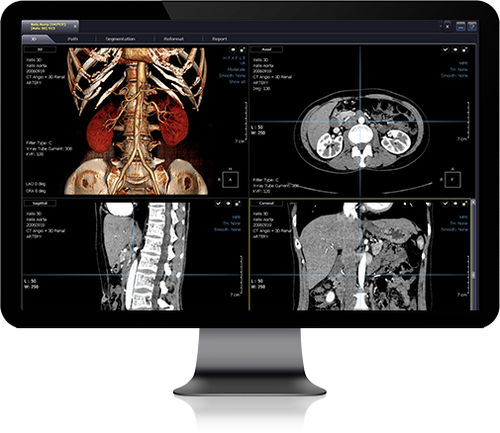 Software de simulação de implante dentário - Xelis - Infinitt Healthcare - de criação de laudos / de visualização / de diagnóstico