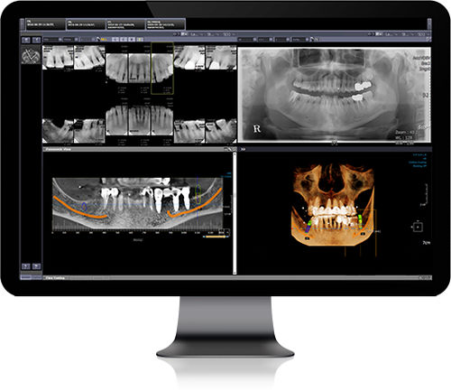 PACS baseado em tecnologia Web - Infinitt Healthcare - para área médica