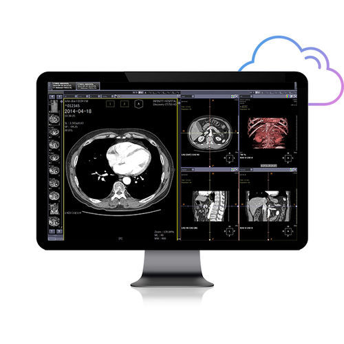 PACS baseado em tecnologia Web - Smart Net - Infinitt Healthcare - para área médica