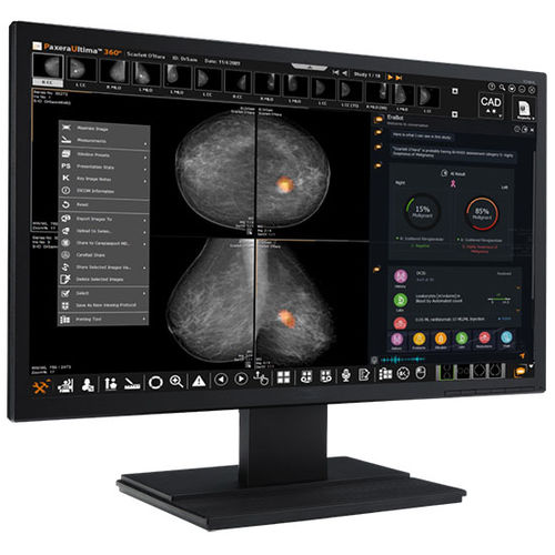 Software médico-hospitalar - Paxera AI - PaxeraHealth Corp - de registro clínico / para TC / para radiologia