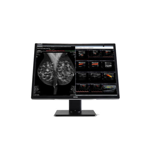Monitor médico - MDNC‑12130 - Barco - de diagnóstico / para mamografia / de alta definição