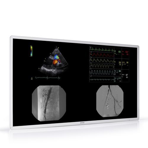 Monitor médico - MDAC-8355 - Barco - para radiologia / de alta definição / com resolução 4K