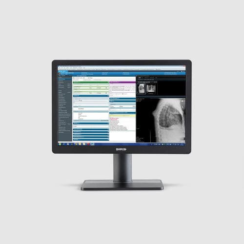 Monitor médico - MDRC‑2424 - Barco - para radiologia / 1920x1200 / 24"