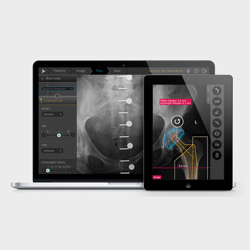 Software médico-hospitalar - TraumaCad® - Brainlab - para hospital / para ortopedia / de pré-operatório
