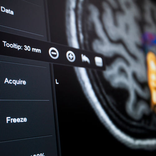 Software de controle - Brainlab - de visualização / de neuronavegação / para hospital