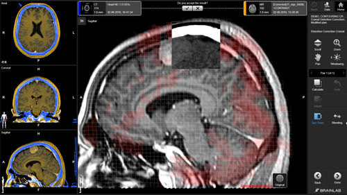 Software de planejamento - Brainlab - de planejamento de tratamento / médico-hospitalar / para neurologia