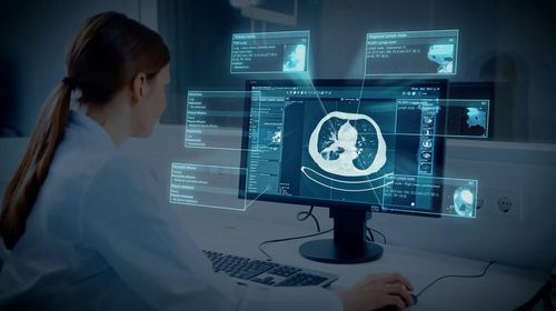 Software de tratamento - Brainlab - com sistema de acompanhamento / médico-hospitalar / de pulmão
