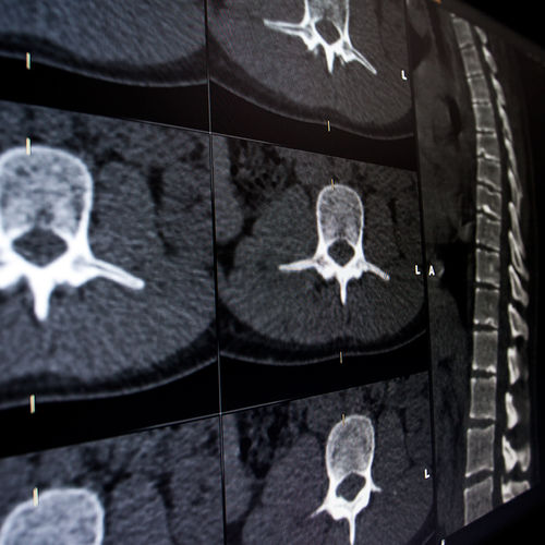 Software médico-hospitalar - Brainlab - para cirurgia da coluna vertebral / para neurologia / de visualização