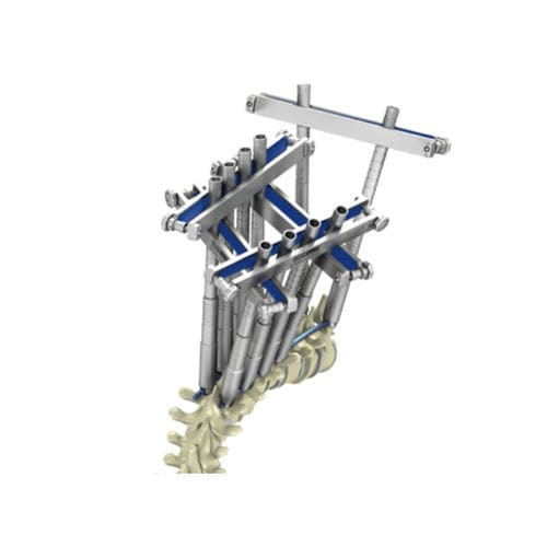 Sistema de posicionamento de parafusos pediculares - CHARSPINE2 VD - ChM