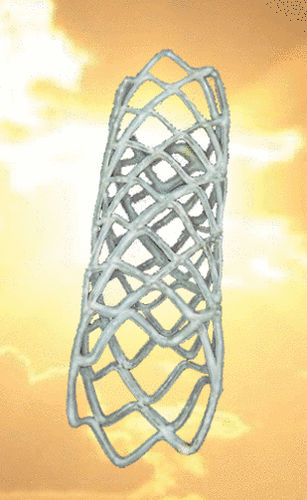 Stent periférico - REMEDY™ - Endocor - metálico