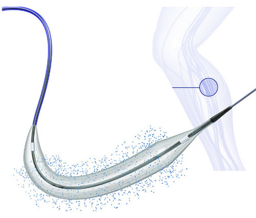 Cateter de dilatação para PTA - BIOPATH™ 014 - Biosensors International - periférico / arterial / para artéria femoral