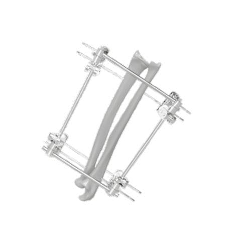 Fixador externo para tíbia - 201551 - SOFEMED International - para fíbula / tubular
