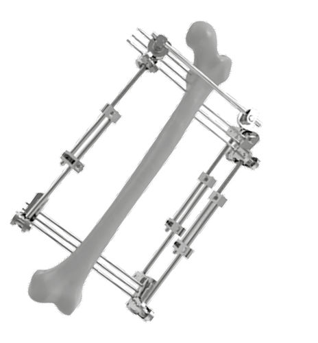 Fixador externo para fêmur - 201501 - SOFEMED International - tubular