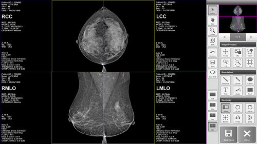 Software de análise de imagens - BRESTATION LITE - MEDI-FUTURE - de gestão / de diagnóstico / de aquisição
