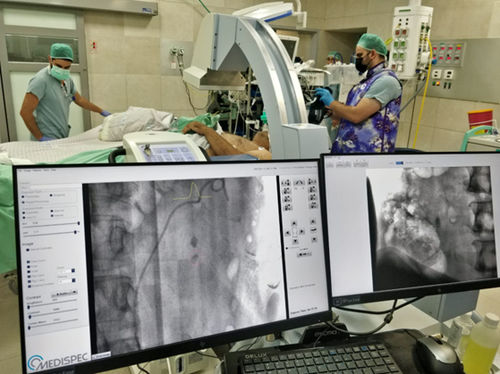 Software de melhoramento de imagens - STONEVISION - Medispec - de controle / de tratamento / de captura
