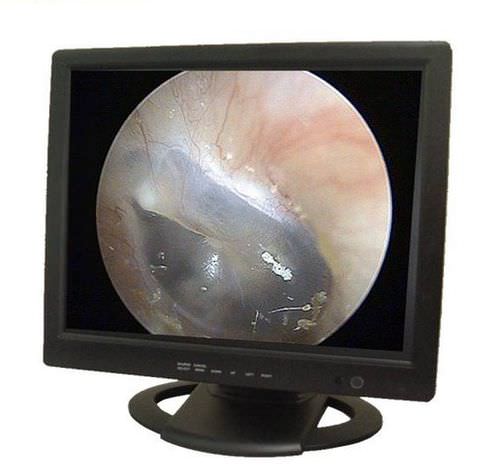 Monitor para endoscopia - PROVIEW 19 - PROVIX  - 19" / LCD