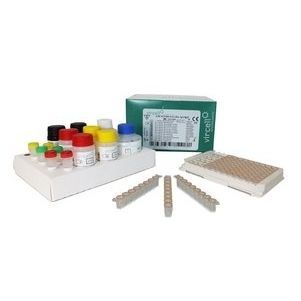 Kit de teste para doenças infecciosas - G/M1004 - Vircell - de globulina / de IgG / de imunoglobulinas M