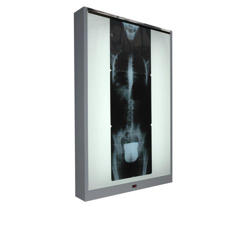 Negatoscópio 1 corpo - M-NV-010	 - Cablas - vertical / de luz branca