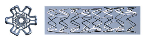 Stent periférico - ProStar - Vascular Concepts