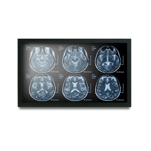 Monitor médico - MEDDP-622 - Onyx Healthcare Inc - 19" / LCD / com retroiluminação LED